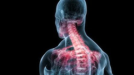Medical Illustration of Spinal Injury and Inflammation - free technology wallpaper 5000×2812